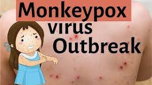 Ευλογιά του ανθρώπου (smallpox), ευλογιά των αγελάδων (cowpox-δαμαλίτιδα) και ευλογιά των πιθήκων (monkeypox)